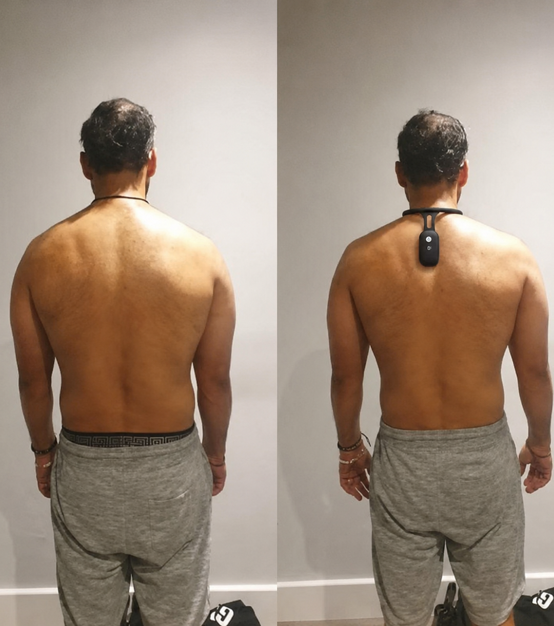 Smart Neck & Posture Corrector