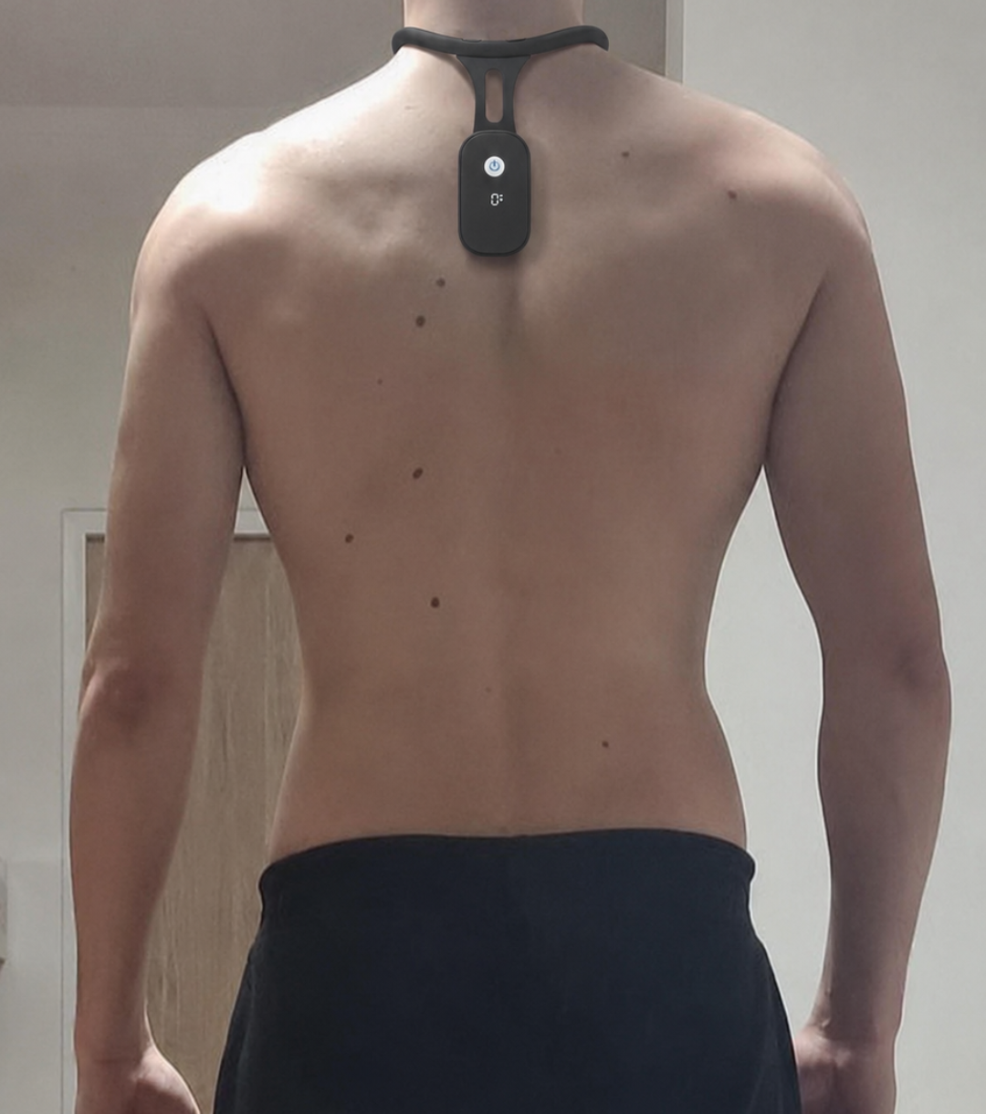 Smart Neck & Posture Corrector