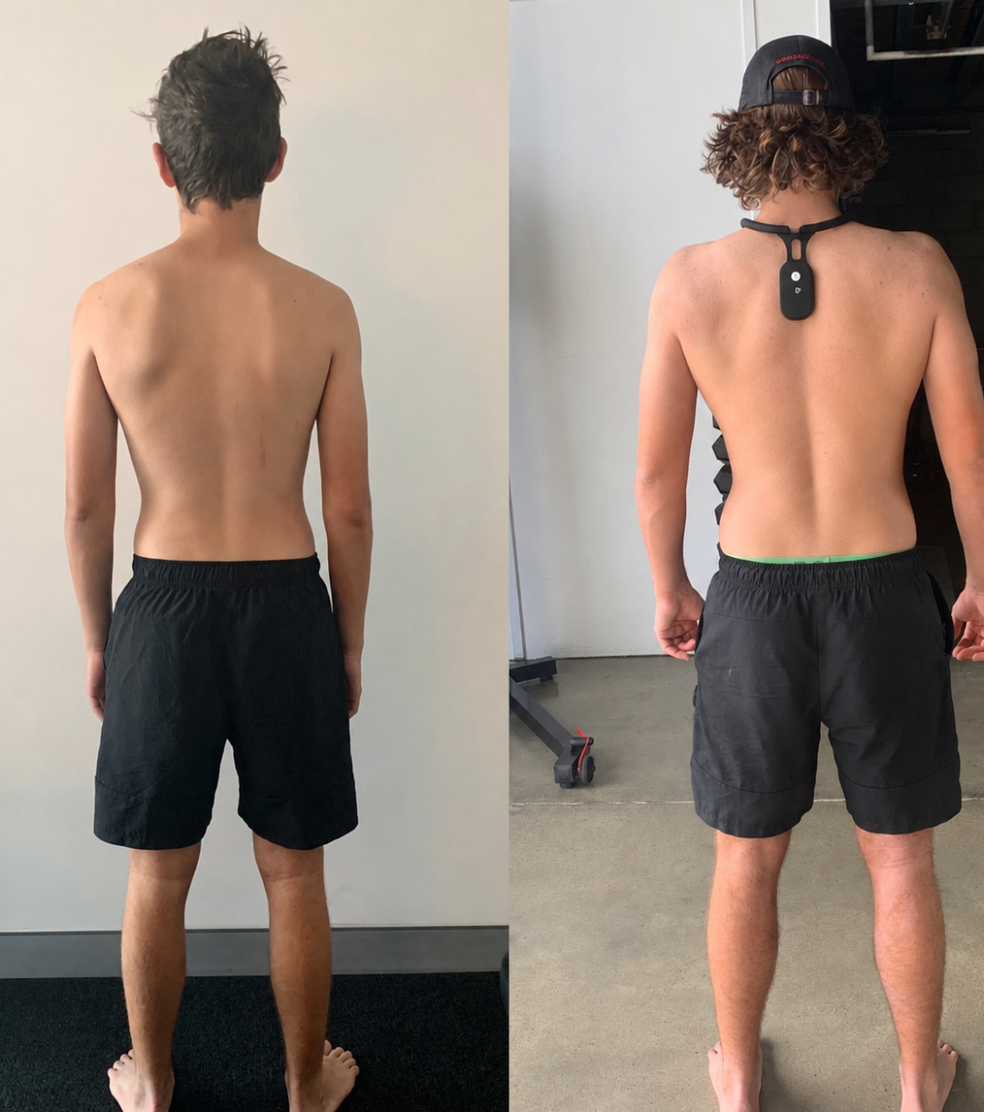 Smart Neck & Posture Corrector