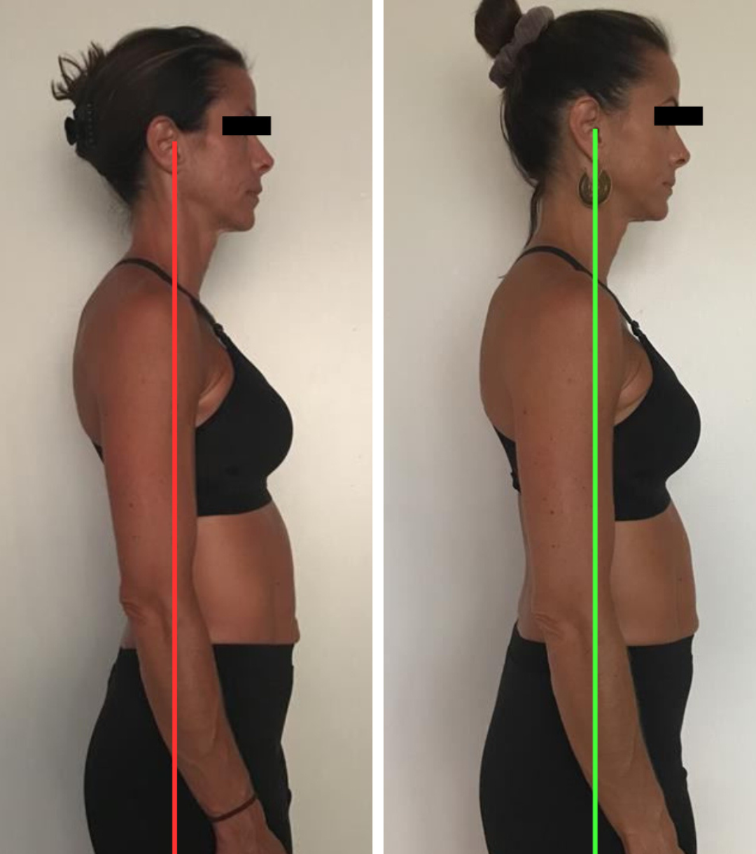 Smart Neck & Posture Corrector